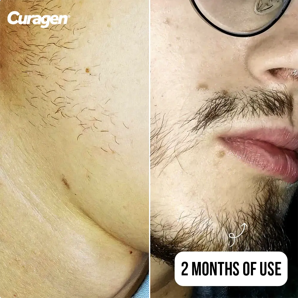 Curagen™ Beard Growth System